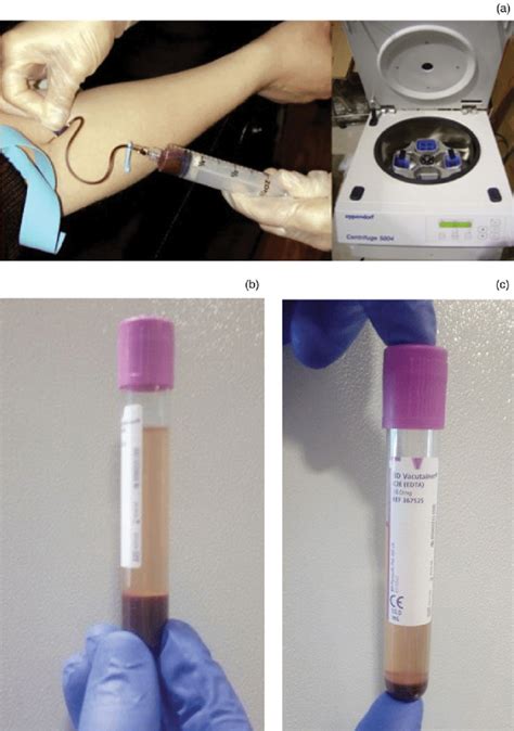 separate blood cells from plasma